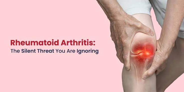 Arthritis
